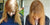 Hair Loss in Women Over 70: Causes, Solutions, and Support